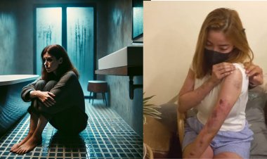 Niat Dapat Kerja Malah Dapat Bogem, Agnes Tio Dianiaya Kekasihnya di Kamar Mandi